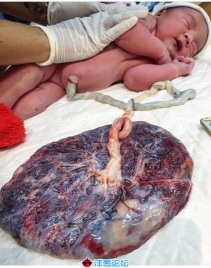 刚出生的婴儿和还在身上的胎盘，太完整了