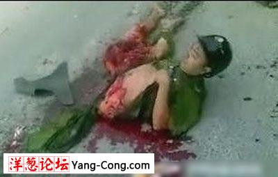 被车碾压成两截的越南交警如今奇迹生还(恐怖视频+组图)
