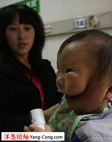 可怜的1岁幼儿天生面部断裂 像戴张面具(组图)