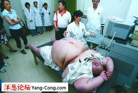 中国第一胖人看病难:体重450斤照CT看不到内脏(图)