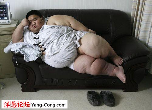 中国第一胖的男子梁用通过排尿将腹水排出(组图)