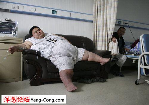 中国第一胖的男子梁用通过排尿将腹水排出(组图)