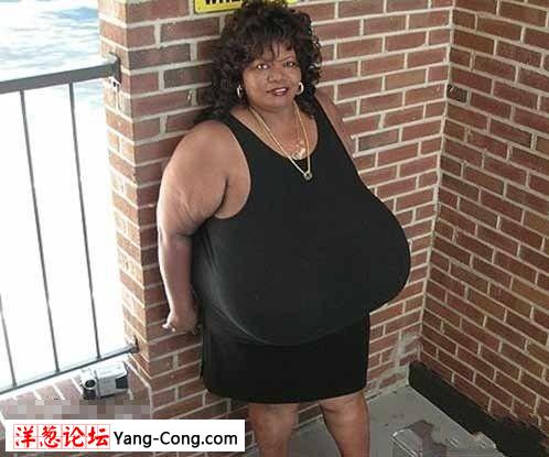 世界最大胸部女子天生豪乳重36斤 连续10年保持纪录(组图)