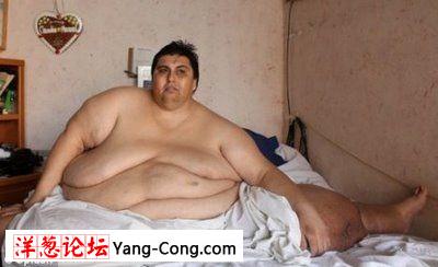 590公斤世界上最胖的人结婚了 夫妻生活怎么过?(组图)