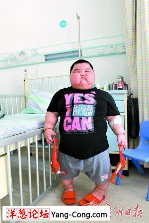 广东佛山3岁男童体重暴增达120斤 智力胜六龄童(组图)