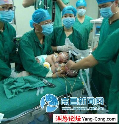 18岁孕妇诞下连体婴儿 手术后成功“分离”(4)