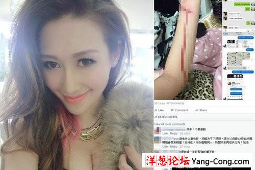 香港嫩模裸照被人网上兜售 割脉以死控诉(1)