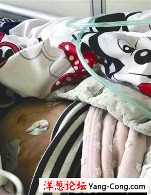 3岁女童因尿裤子被生父打致住院(2)