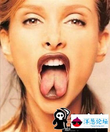 拥有重复器官的奇人：女子有两个舌头(1)