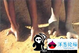 只有两根脚趾照样跑 揭秘非洲龙虾民族(2)