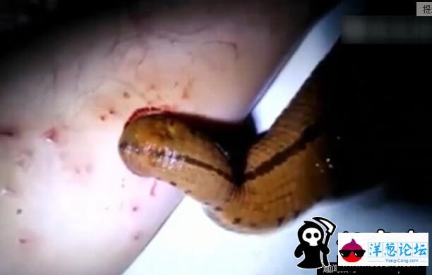 日本男子养巨型水蛭当宠物 用自己的血喂养(4)