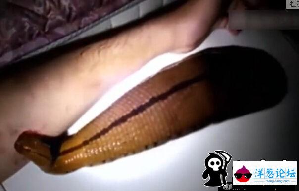 日本男子养巨型水蛭当宠物 用自己的血喂养(2)