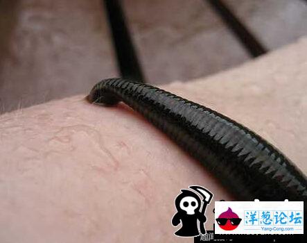 日本男子养巨型水蛭当宠物 用自己的血喂养(8)