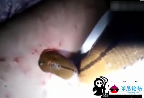 日本男子养巨型水蛭当宠物 用自己的血喂养(3)