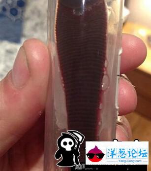 日本男子养巨型水蛭当宠物 用自己的血喂养(5)