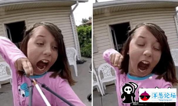 11岁女孩自己拉动弓弩拔牙 盘点拔牙奇葩事(2)