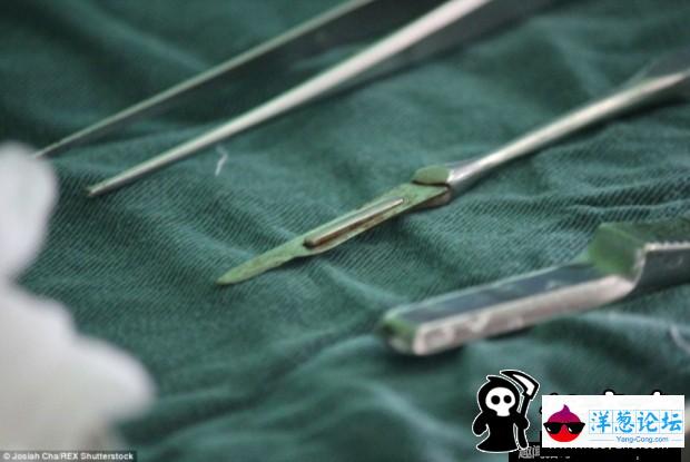 摄影师拍朝鲜手术室 灯光昏暗手术刀生锈(2)